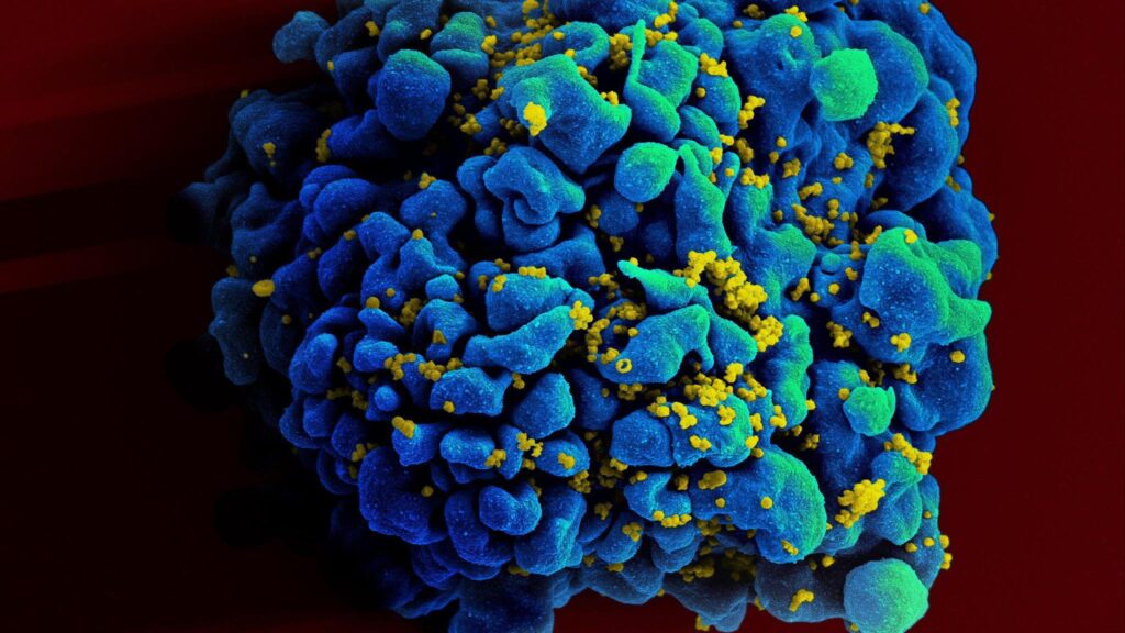 woman cured of hiv