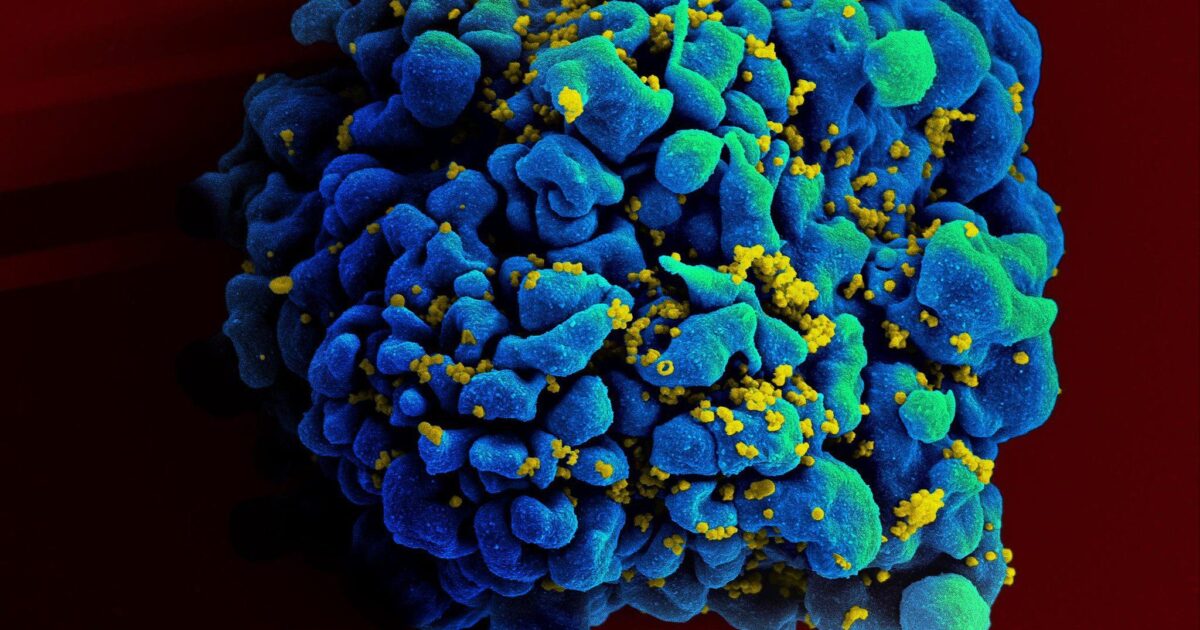 woman cured of hiv