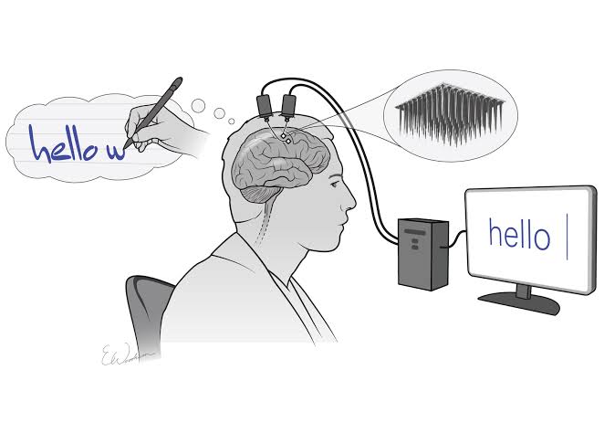 The BCI system