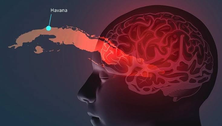 Havana Syndrome | New Ailment Linked To Russia 2 Havana syndrome