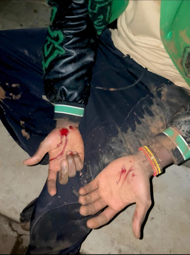 WYclef Cabana Survives a Nasty Accident