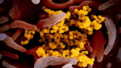 HMPV Virus Outbreak | What We Know So Far 1 China is witnessing a surge in cases of HMPV, predominantly affecting children under 14 years of age.