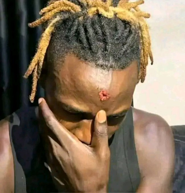 Alien Skin Attacked in Iganga, Sustains Head Injury After Weekend Performance.