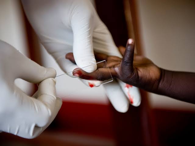 Uganda gets HIV Prevention Injection | 100% Effective