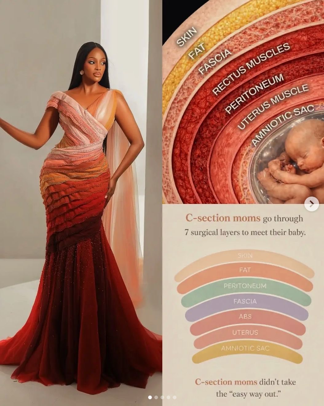 Miss World Uganda is trending for unique C-Section dress 6 Miss World Uganda is trending for unique C-Section dress